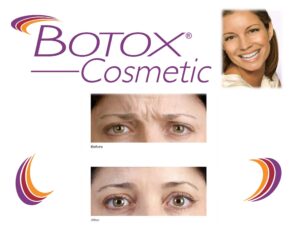 Botox bucuresti