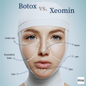 botox bucuresti