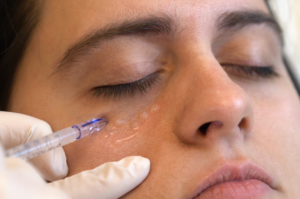 alnire cearcane bucuresti