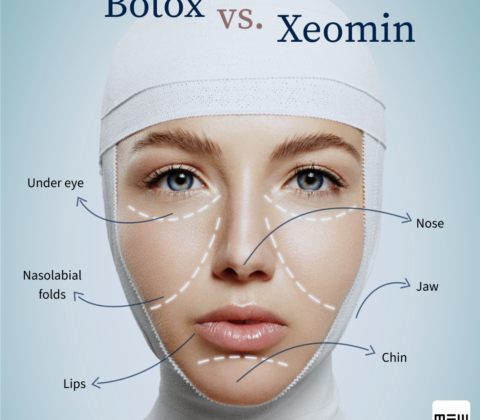 xeomin botox Bucuresti