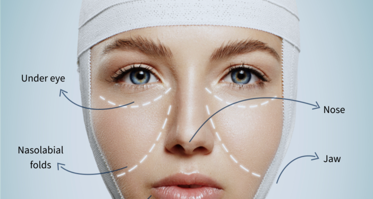 xeomin botox Bucuresti