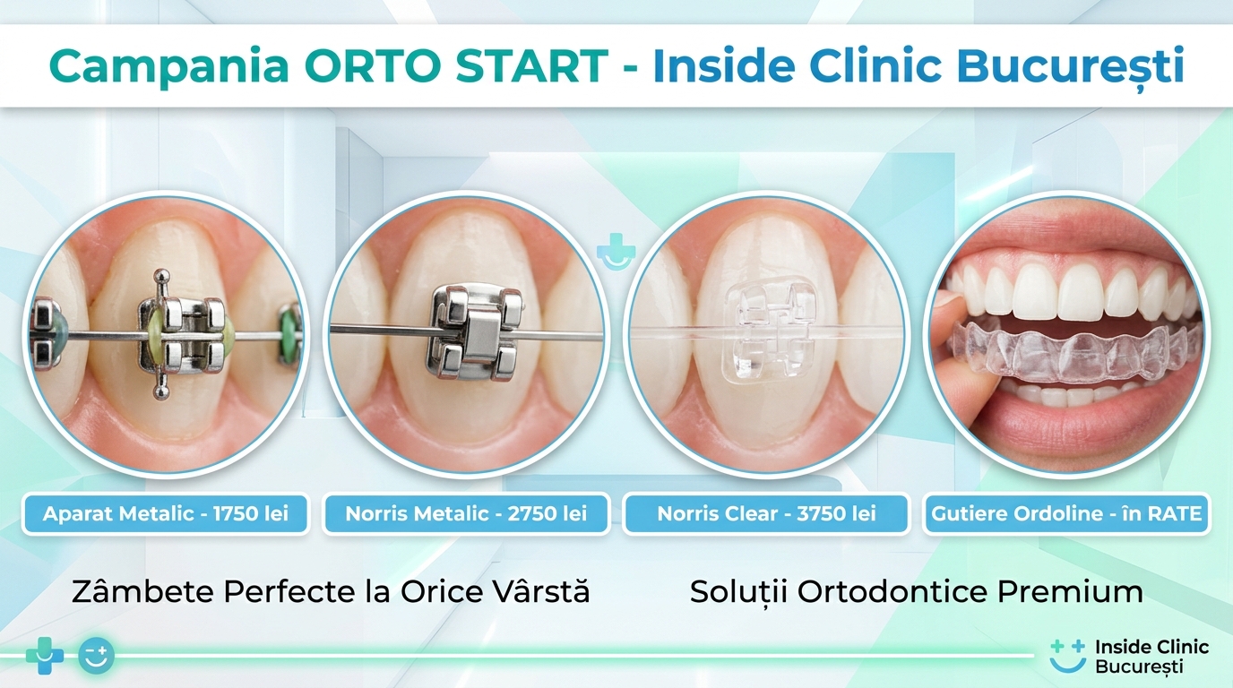 aparat dentar ieftin buuresti aparat dentar ieftin